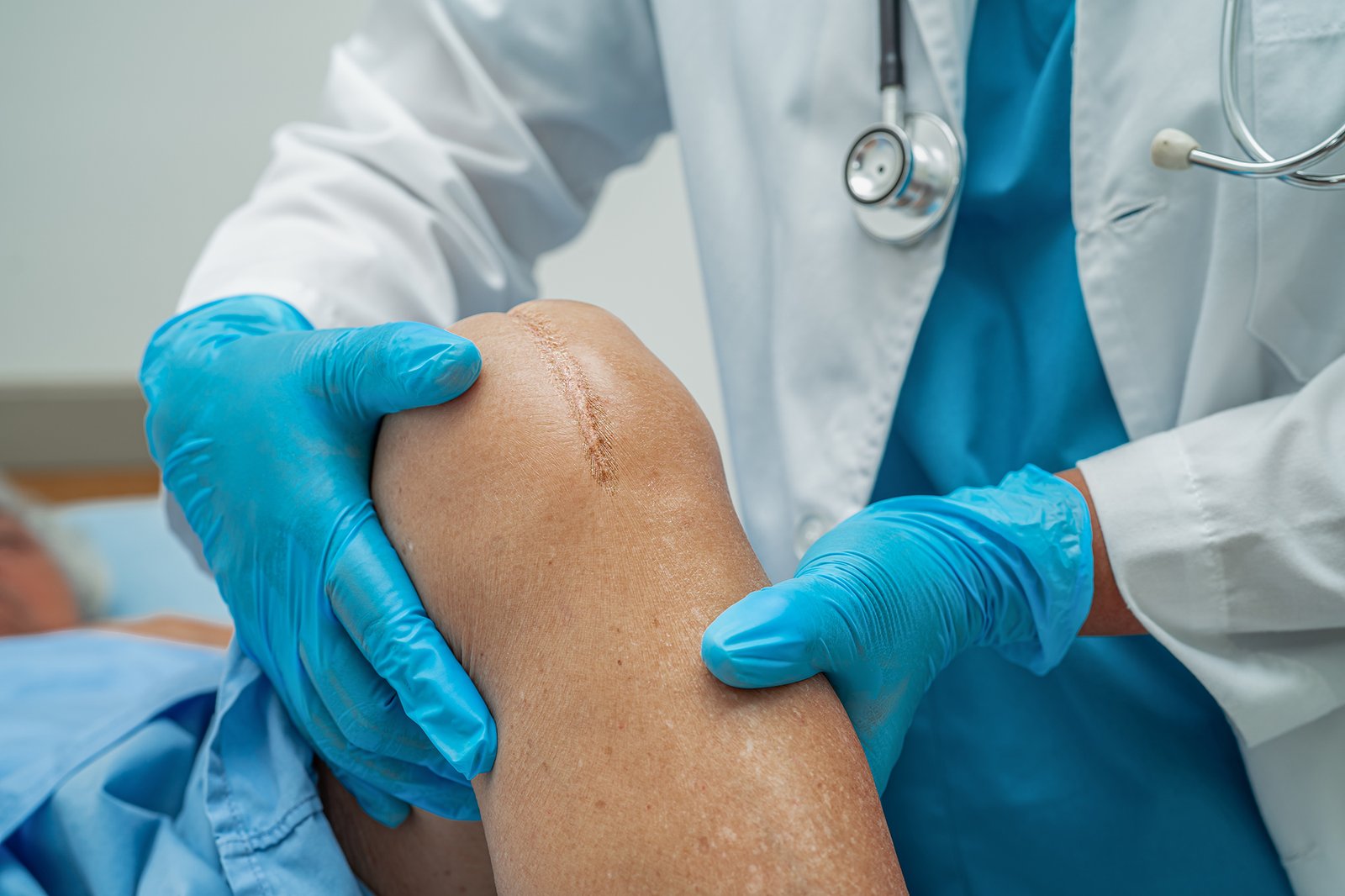 Why Orthopedic Surgeon in Ranchi Trust Arthroscopy for Joint issues?