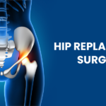 How to Find the Right Hip Replacement Surgeon in Ranchi for Your Needs?