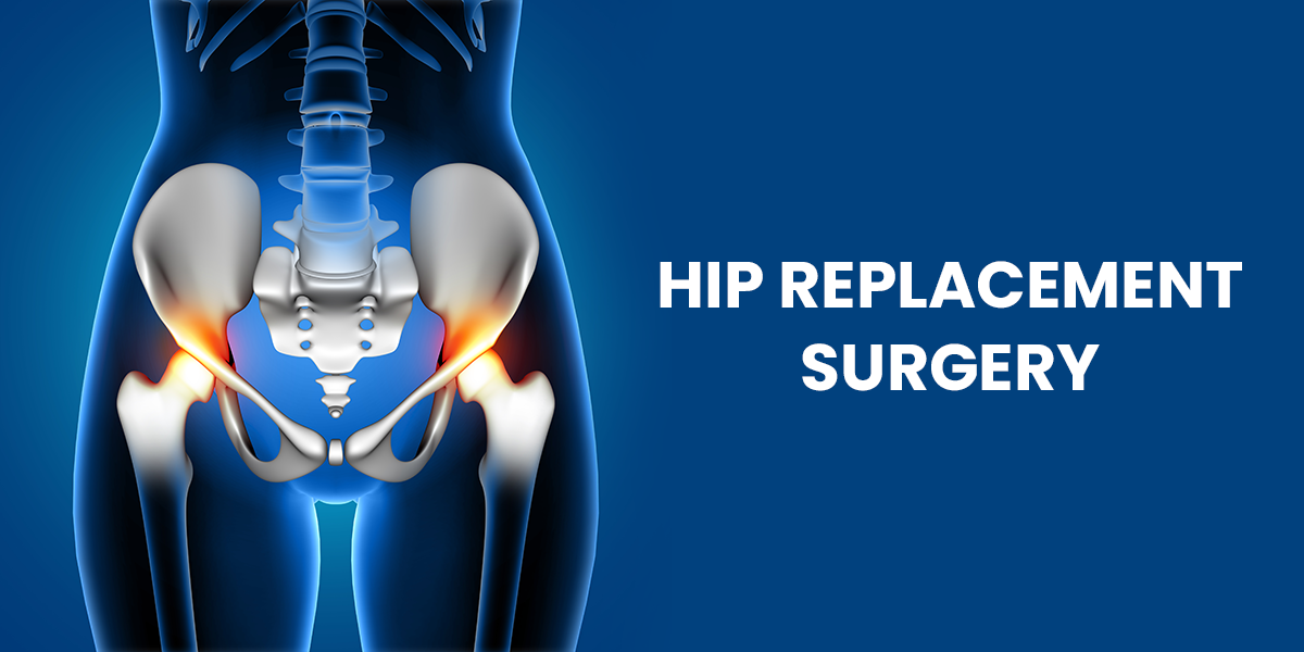 How to Find the Right Hip Replacement Surgeon in Ranchi for Your Needs?