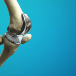 Experience Pain-Free Treatment Joint Replacement Surgeon in Ranchi